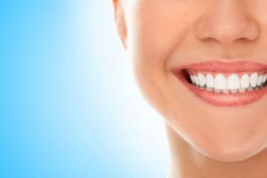 Diseño Sonrisa Pineda de Mar | Clínica Dental Blanc