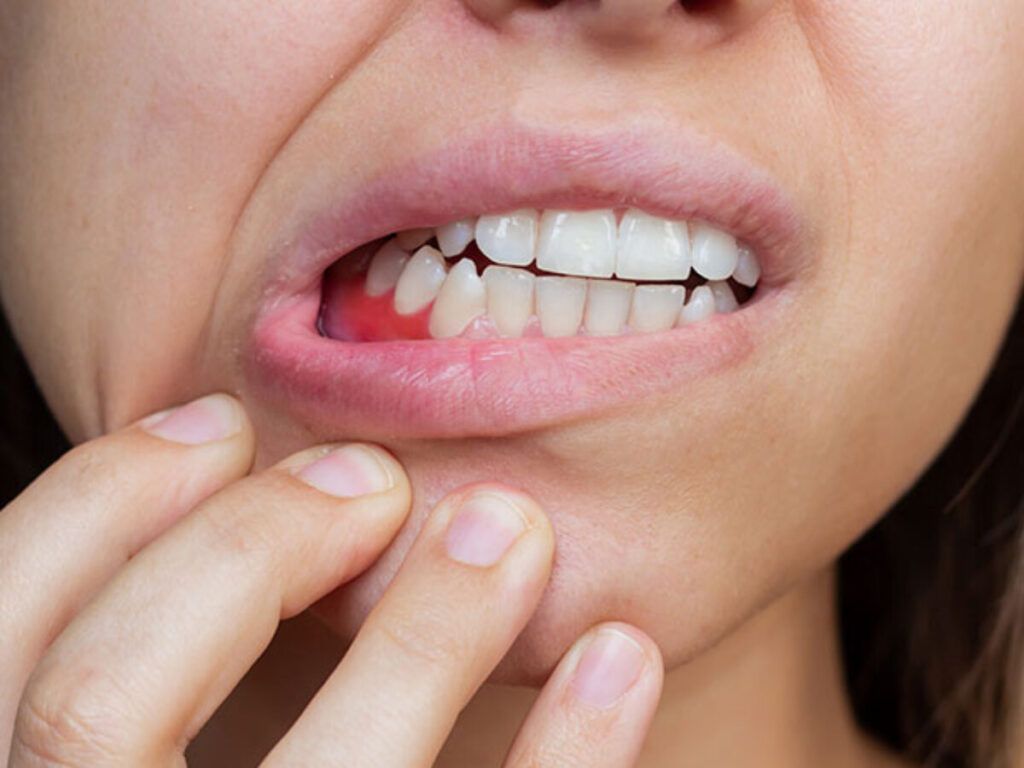 Tratamiento Periodoncia Pineda de Mar | Clínica Dental Blanc